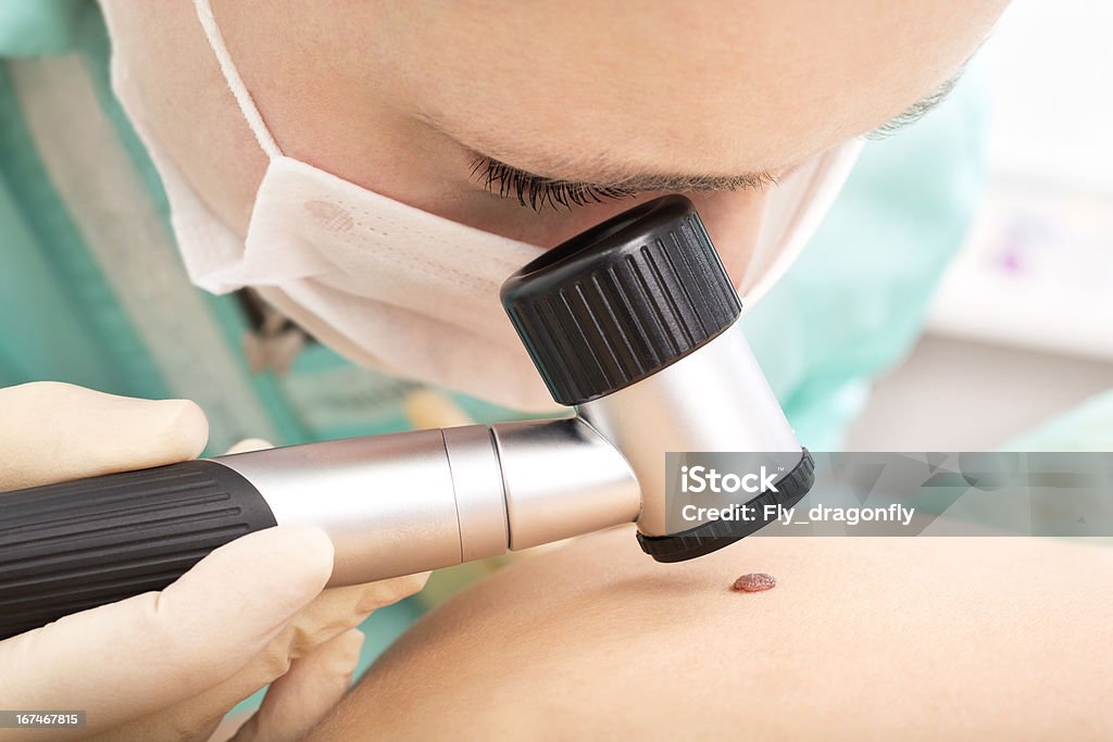 Dermatologist studies birthmark using dermatoscope Mole checkup. Professional dermoscopy Dermatology Stock Photo