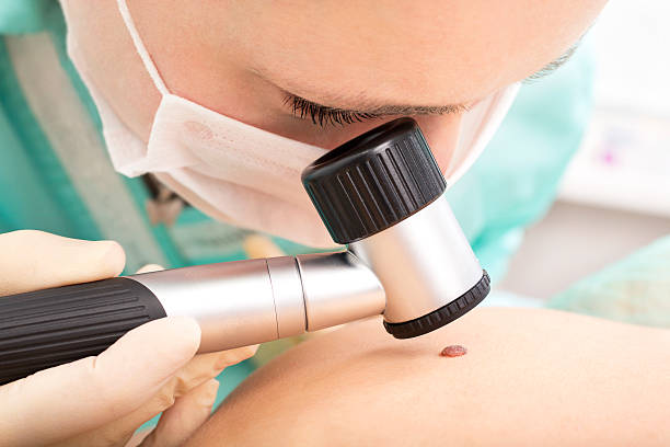 Dermatologist studies birthmark using dermatoscope Mole checkup. Professional dermoscopy dermatology photos stock pictures, royalty-free photos & images