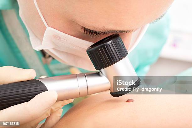 Dermatologist Studies Birthmark Using Dermatoscope Stock Photo - Download Image Now - Dermatology, Melanoma, Mole - Skin