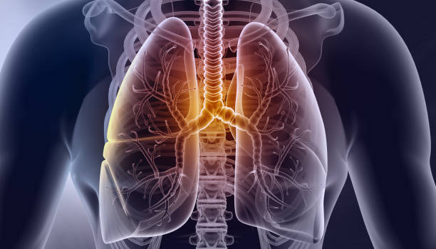 istock Human lungs anatomy on medical background 1675841259