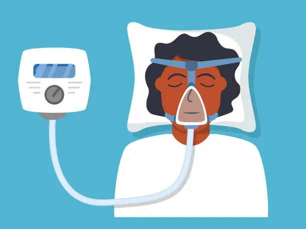 Vector illustration of Continuous positive airway pressure.Obstructive sleep apnea.African american man lying on bed.Cpap mask.