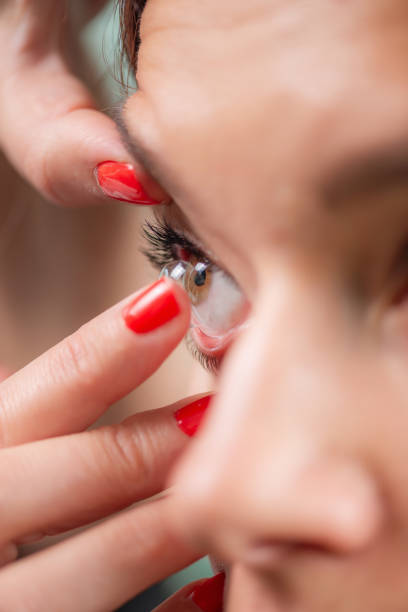 istock Soft Contact Lens Insertion in Ophthalmology 1676081393