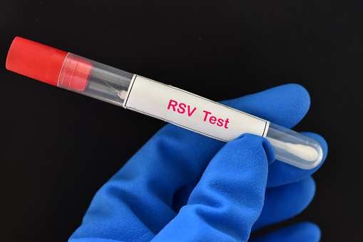 Nasopharyngeal swab from patient for respiratory syncytial virus (RSV) test