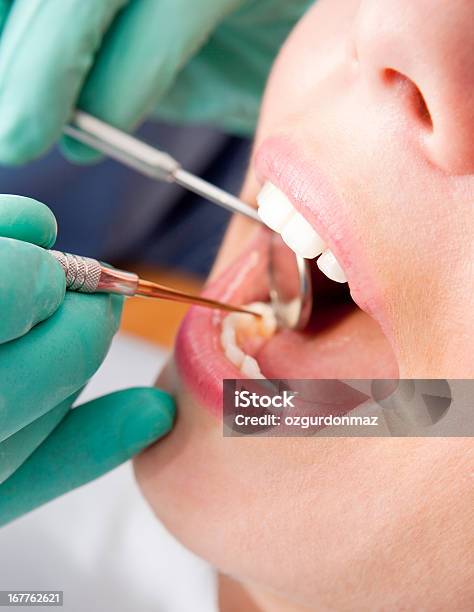 Controllo Dentale - Fotografie stock e altre immagini di Abilità - Abilità, Adulto, Ambulatorio dentistico