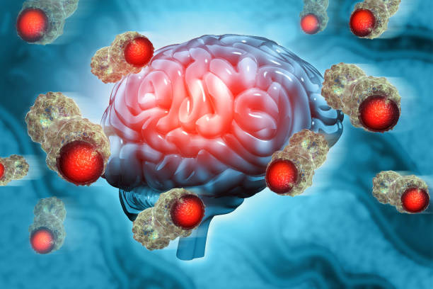 istock Cancer cells attacking a human brain. 3d illustration 1678181503