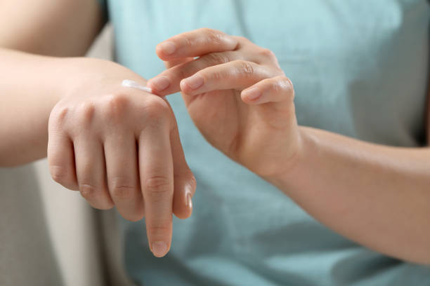 istock Woman applying ointment onto her hand, closeup 1678836642