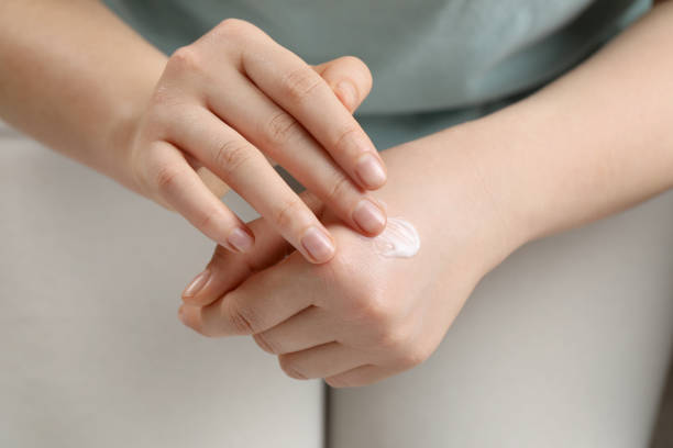 istock Woman applying ointment onto her hand, closeup 1678838317