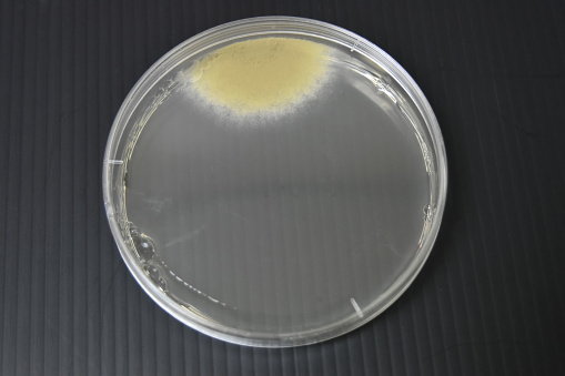 Colonies of bacteria growth on agar plate medium in microbiology laboratory.