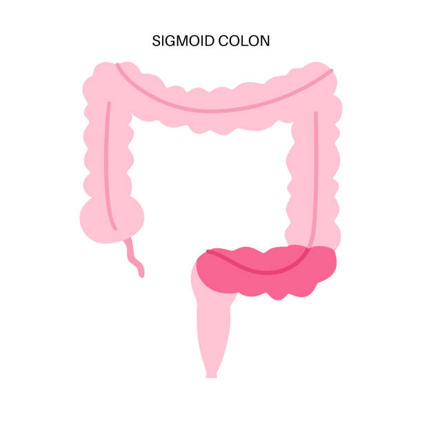 Large intestine anatomy Sigmoid colon poster. Large intestine in the human body. Gastrointestinal disease, diagnostic and treatment in gastroenterology clinic. Digestive tract, examination of bowel vector illustration intestinal wall stock illustrations