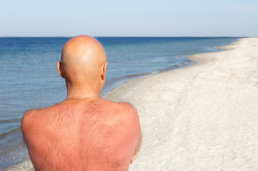 Ukraine, Kinburn spit, 08/26/2016: Close-up rear view of a bald man with a hairy back on the beach. Rear view. Male alopecia
