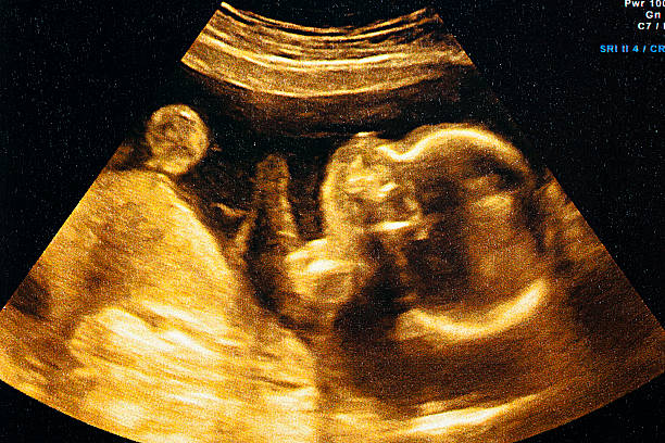 Ultrasound of a woman's fetus at 37 weeks stock photo