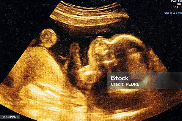 Ultrasound Of A Womans Fetus At 37 Weeks Stock Photo - Download Image Now - Ultrasound, Baby - Human Age, Uterus
