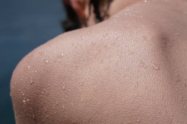 Wet cold skin with goose bums