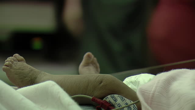 Premature Baby at Neonatal Intensive Care Unit in Hospital. Closeup.