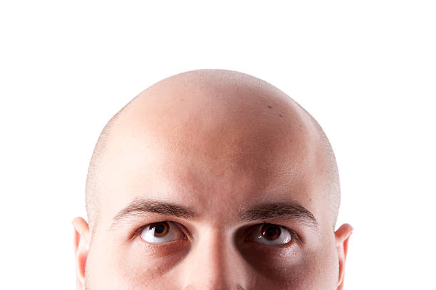 bald head - human scalp photos et images de collection