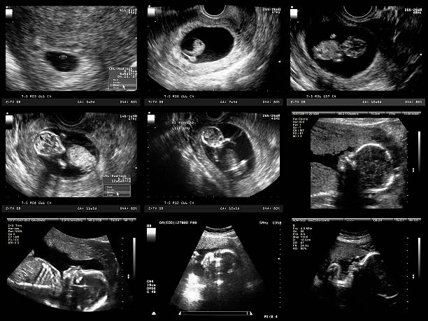 schwangerschaft ultraschall-untersuchung - fetus stock-fotos und bilder