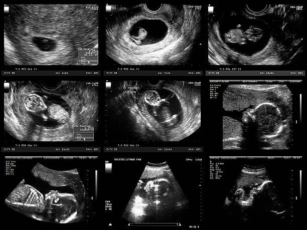 Pregnancy Ultrasound Medical imaging of various stages of embryo and fetal development during pregnancy. Progression includes: ultrasound photos stock pictures, royalty-free photos & images