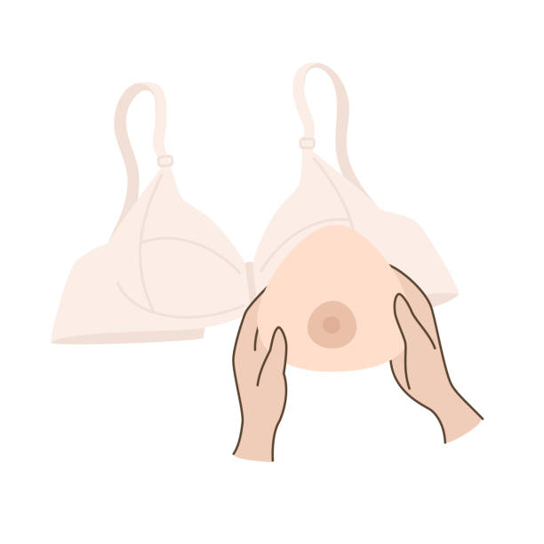 Breast prosthesis vector illustration. Hands holding Breast prosthesis. Breast prosthesis and post surgery bra for breast cancer patient after mastectomy. Vector illustration. silicone implants stock illustrations