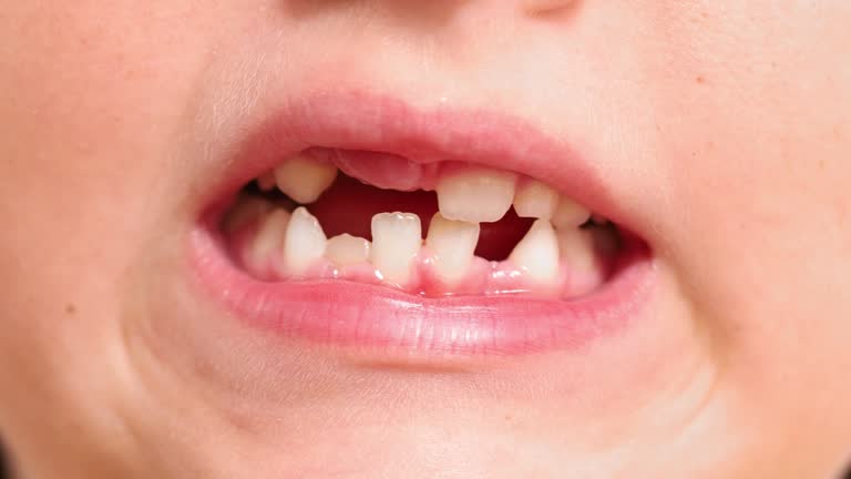 Close up video unrecognizable child toothless mouth with milk teeth, compressing and open jaw. Dentist and hygiene care