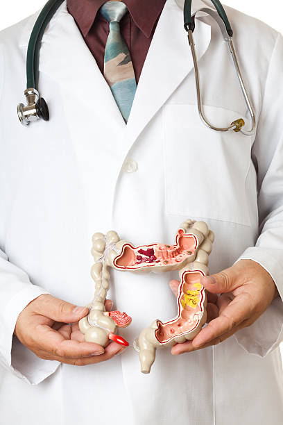 istock Large intestine held by a doctor 168505126