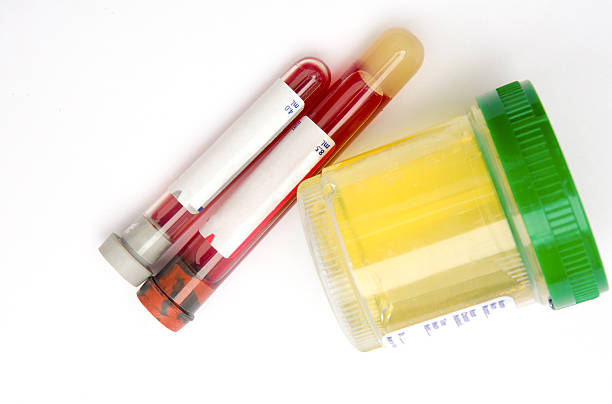 médecine: stérile flacon d'urine et de test sanguin - medical sample photos et images de collection