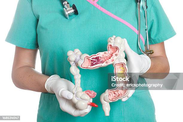 Colon Foto de stock y más banco de imágenes de Apendicitis - Apendicitis, Colon, Doctor