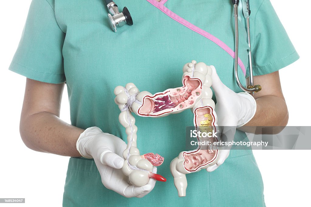 Colon Female nurse holding anatomical model of human colon with pathologies. The model shows appendicitis, cancer, Crohn’s disease, spastic colon, ulcerative colitis, polyps, diverticulosis, diverticulitis, bacterial infection and adhesions. Appendicitis Stock Photo