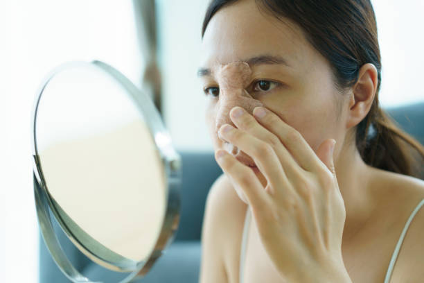 istock Woman face after nose plastic surgery. 1685810186