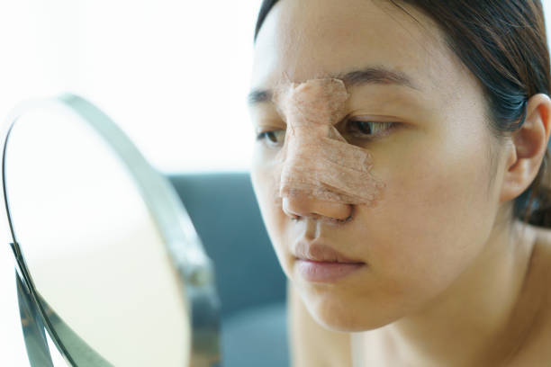 istock Woman face after nose plastic surgery. 1685810196