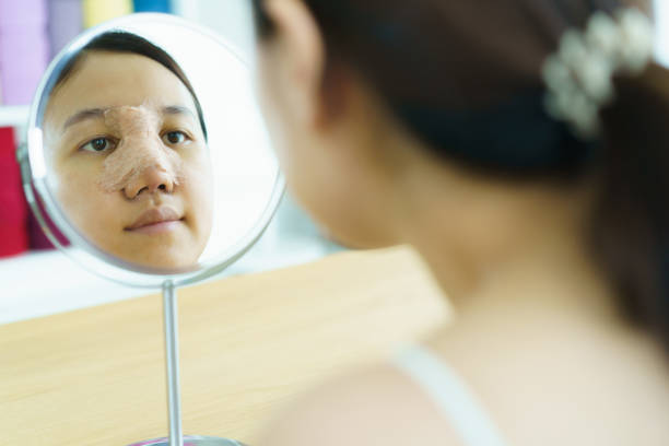 istock Woman face after nose plastic surgery. 1685810199