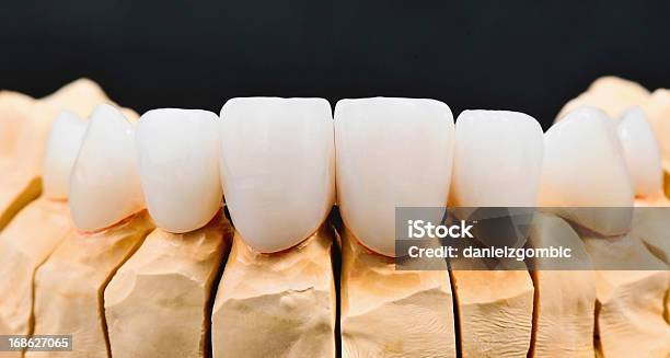 Folheados De Dentista - Fotografias de stock e mais imagens de Dente de Engrenagem - Dente de Engrenagem, Equipamento Dentário, Faceta estética