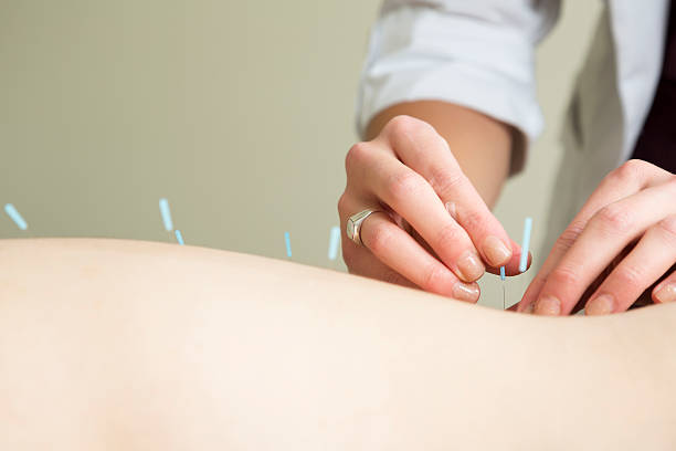 istock Hands of acupuncture therapist inserting a needle 168635037