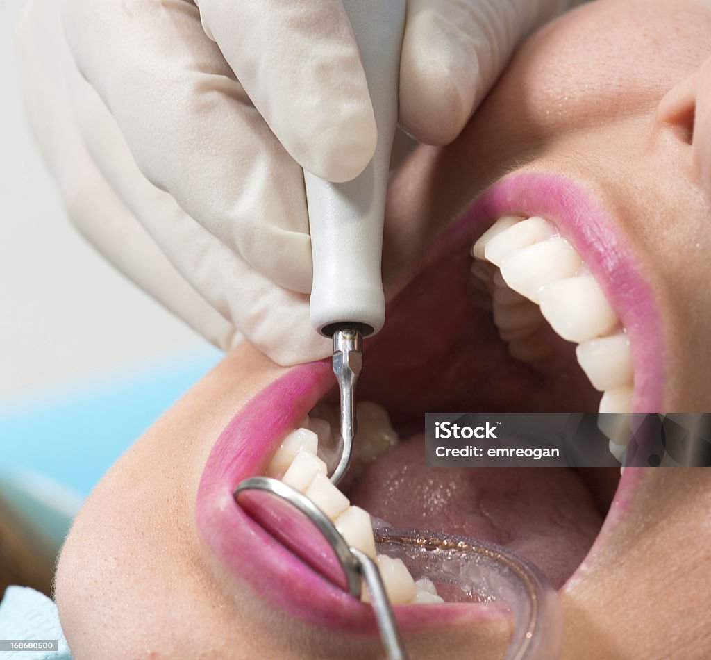 Dentista pesquisa exame dentário close-up - Foto de stock de Adulto royalty-free