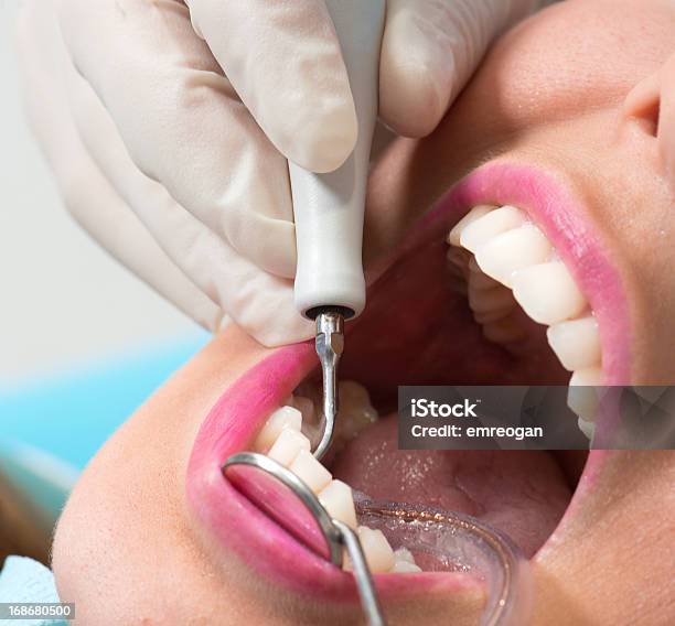 Foto de Dentista Pesquisa Exame Dentário Closeup e mais fotos de stock de Adulto - Adulto, Azul, Beleza