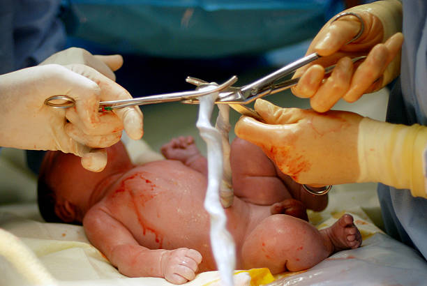 istock Cutting of the Umbilical Cord 168712974