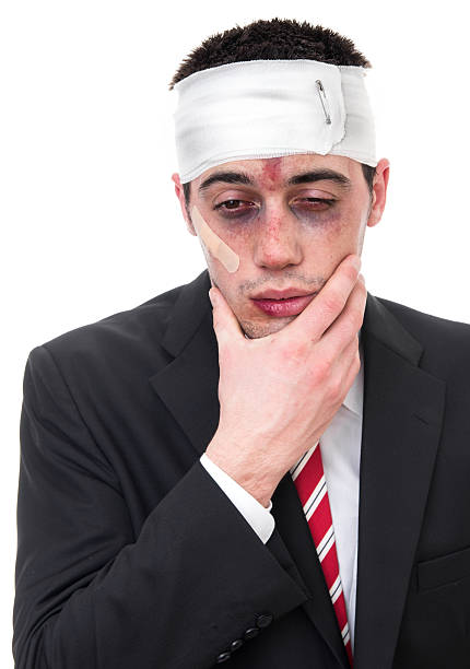 istock Man with bruised eyes and head 168713175