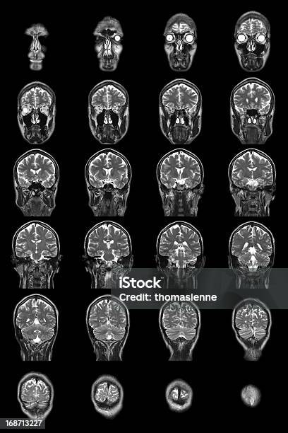 La Mri Del Cerebro Humano Foto de stock y más banco de imágenes de Cabeza humana - Cabeza humana, Cerebro humano, En blanco