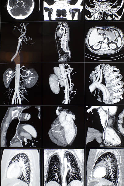 istock The human organs X-ray photos 168769850