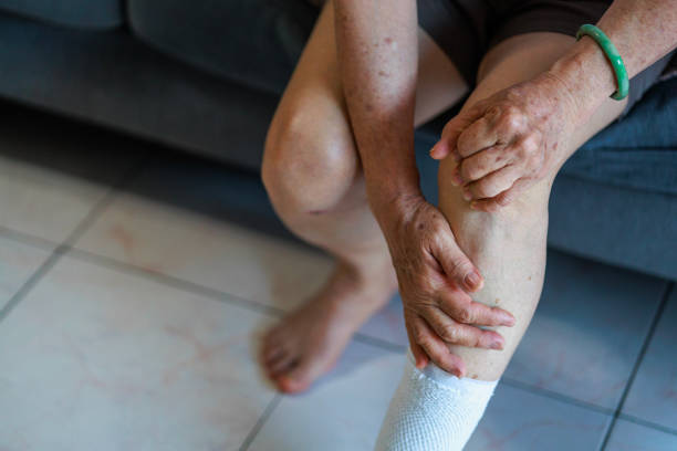 starsza azjatka masuje kolano, siedząc na sofie w salonie w domu, wyraźnie cierpiąc na ból kolana - arthritis senior adult rheumatoid arthritis sadness zdjęcia i obrazy z banku zdjęć