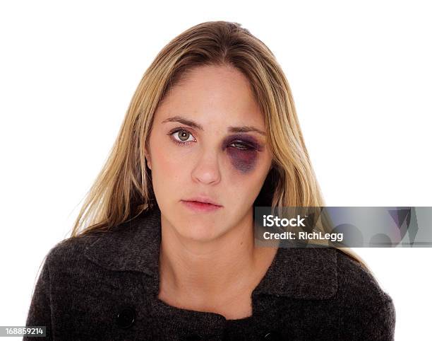 Photo libre de droit de Femme Avec Oeil Au Beurre Noir banque d'images et plus d'images libres de droit de Femmes - Femmes, Coup, Ecchymose