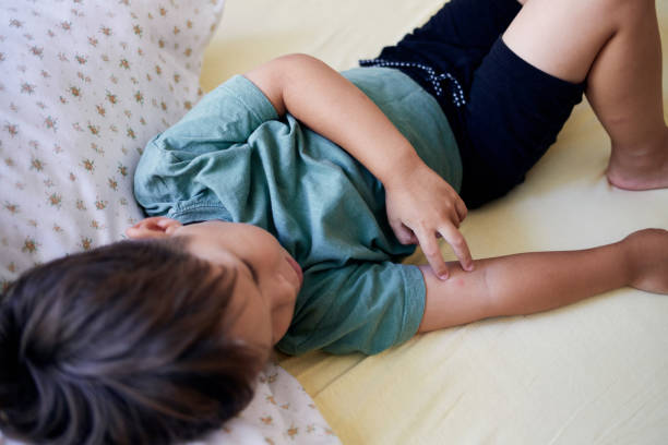 mosquito bites sore and scar on child hand, a boy scratching at lesion. - mosquito child bug bite scratching imagens e fotografias de stock