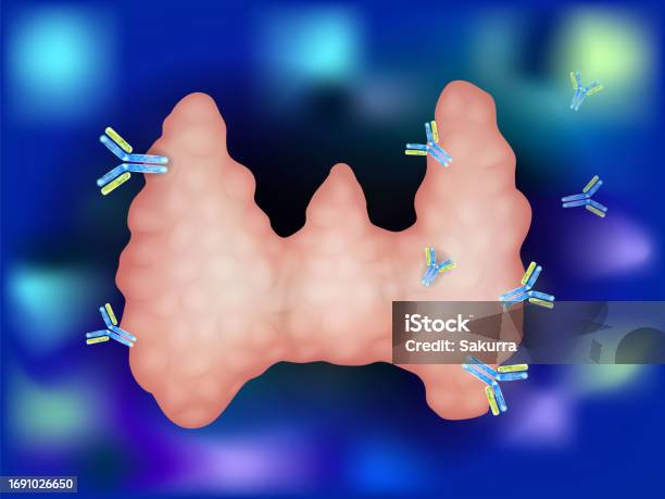 Tiroiditis Illustration Showing Antibodies Attacking Thyroid Gland Autoimmune ...