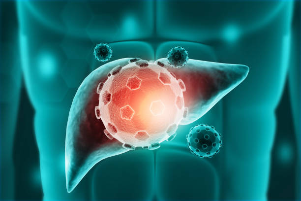 istock Hepatitis virus attack in human liver 1691924238