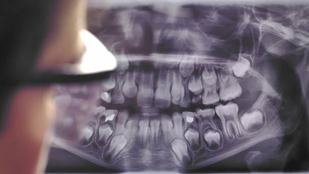 istock Panoramic Dental X-Ray Image Examined by Female Dentist in Protective Glasses 1692072990