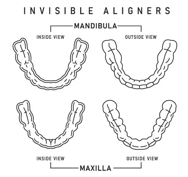 Vector illustration of Orthodontic silicone trainer. Invisible braces aligner, retainer.