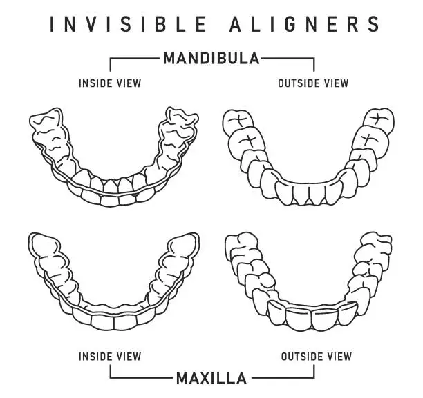 Vector illustration of Orthodontic silicone trainer. Invisible braces aligner, retainer.