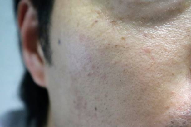 istock Japanese man with rough skin 1692323793