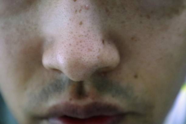 istock Japanese men's nose stains 1692324965