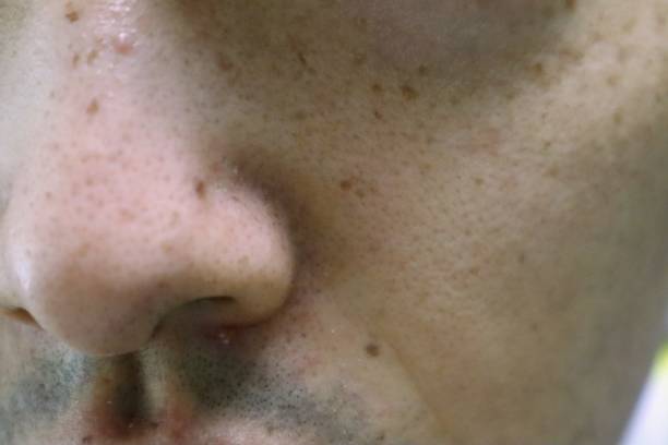 istock Japanese man with rough skin 1692326113