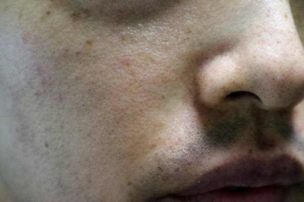 istock Japanese man with rough skin 1692340578